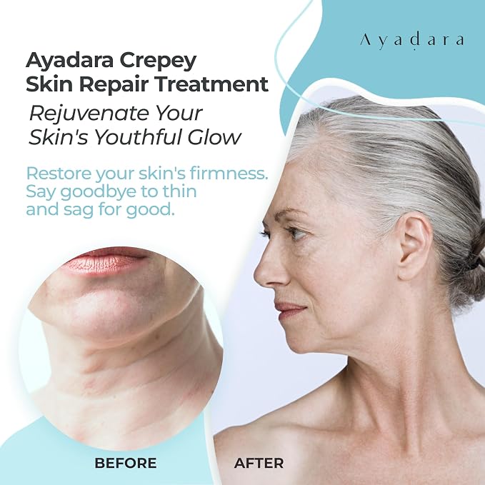 Crepey Skin Repair cream 8oz, Firming Lotion - Image 3