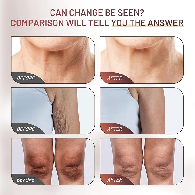 Moisturizing Crepe Fix Cream – Tightens and Firms Face, Neck & Body, Anti - Image 5