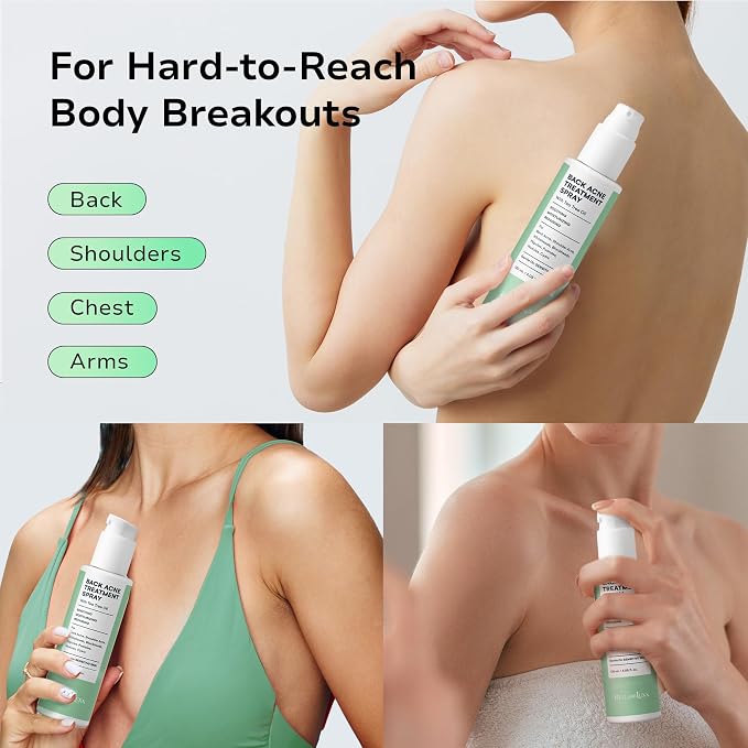 Back and Body Acne Treatment Spray: 2% Salicylic Acid & Tea Tree Oil Bacne Spray - Image 4
