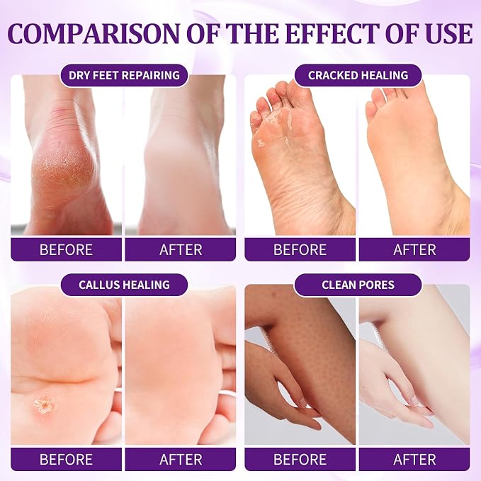 24 PCS Foot Soak, Pedicure Kit Foot Soak Set - Image 3