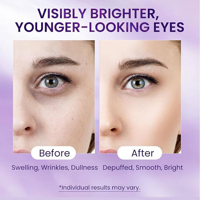 Caffeine & Retinol Eye Serum – Hydrating Under Eye Serum to Help Reduce the - Image 2