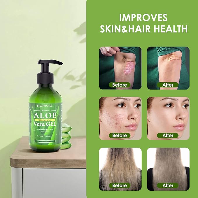Aloe Vera Gel, 100% Aloe Vera from Freshly Cut Aloe Leaves, Skin Care - Image 5