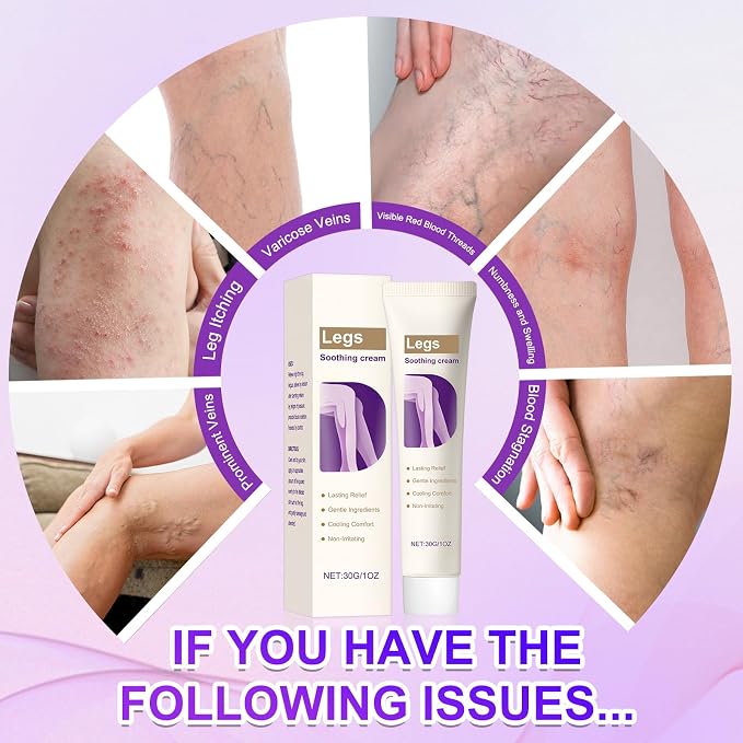 2Pcs Soothing Leg Cream –Varicose Veins Relief, Cooling Gel - Image 6