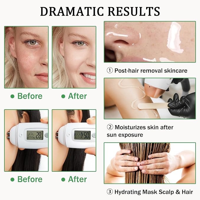 Aloe Vera Gel for Sunburn Relief, Hydrating Travel Size Aloe Vera Gel for Face - Image 4