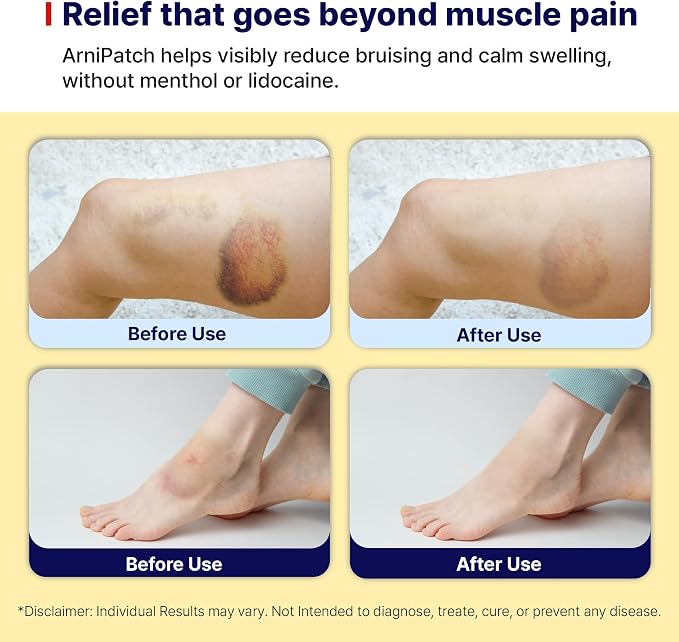 Arnica Hydrogel Pain Relief Patches | Natural Relief - Image 6