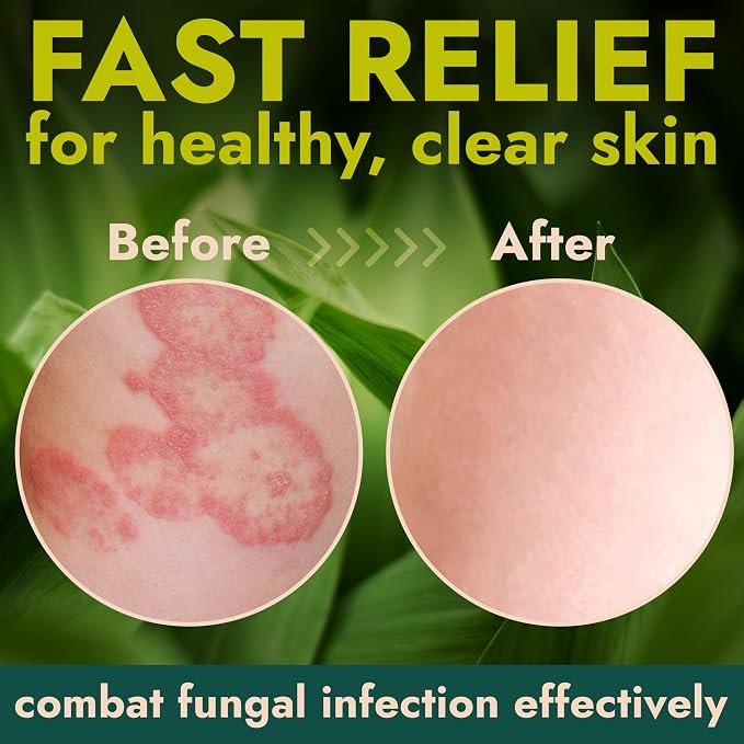Antibacterial Body Lotion | Kills 99.9% of Germs & Bacteria | Body Lotion - Image 5