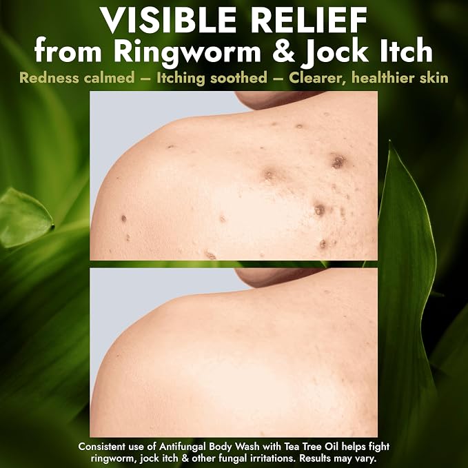 Antifungal Body Wash with Tea Tree Oil | Antibacterial Soap - Image 8