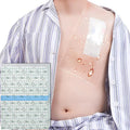 10" x 12" Shower Shields Wound Cover, Large Waterproof Bandages by Unknown