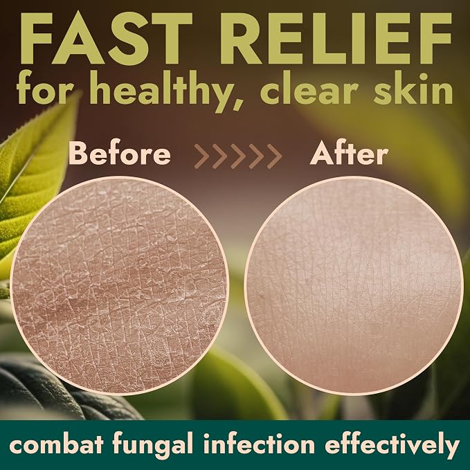 Antifungal Body Wash with Tea Tree Oil | Antibacterial Soap - Image 4