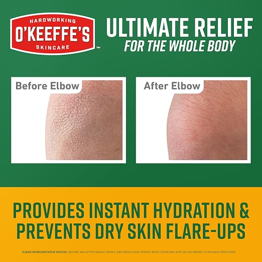 O’Keeffe’s Skin Repair Ultimate Relief Body Cream, 7oz Tube – - Image 2