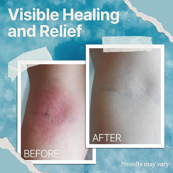 The Ocean Healed My Eczema Natural & Soothing Eczema Cream - Image 6