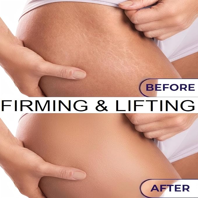 Firming Body Oil with Plant extracts enriched with Vitamin E and Rosehip Extract - Image 5