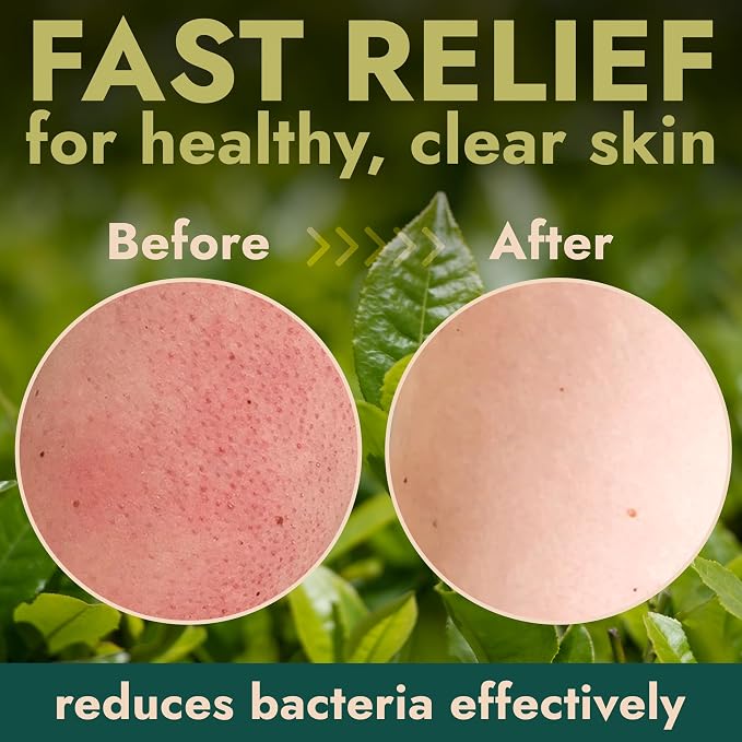 Antibacterial Body Scrub | Manuka Honey & Charcoal | Kills 99.9% of Germs & - Image 5