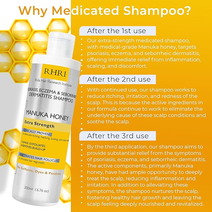 Psoriasis Shampoo for Men & Women | Itchy Scalp Treatment - Image 3