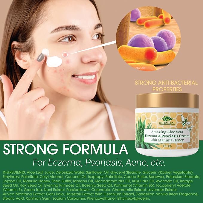 Manuka Honey Eczema Cream Moisturizing Lotion Treatment - Image 2
