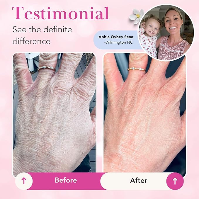 Theraplex Clear Emollient Lotion - Image 6