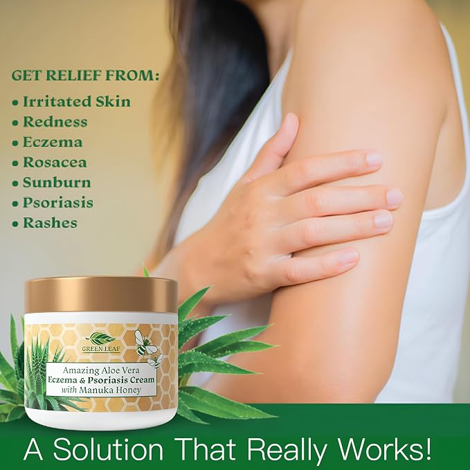 Manuka Honey Eczema Cream Moisturizing Lotion Treatment - Image 2