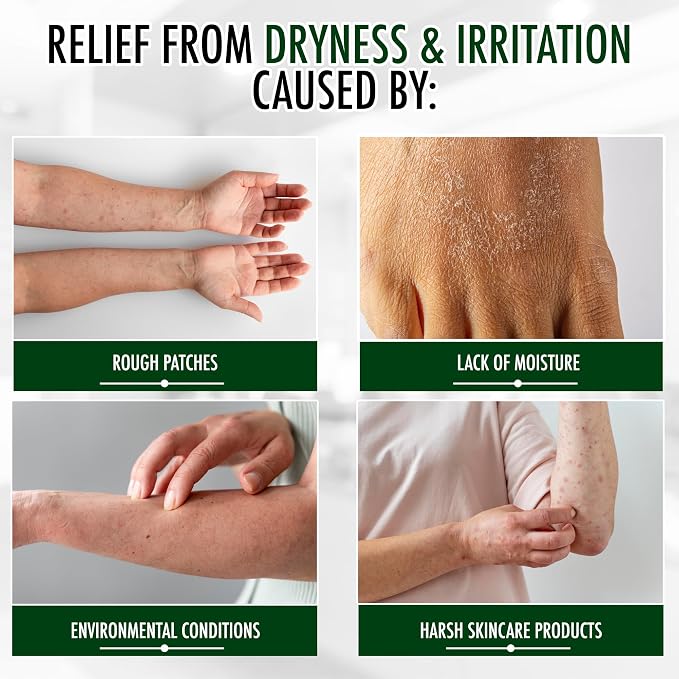 GLY MIRACLE Unscented Travel Lotion Tubes – Non-Greasy Skin Moisturizer - Image 8