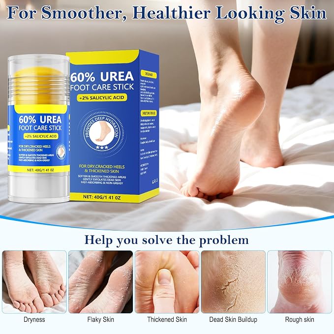 60% Urea & 2% Salicylic Acid Foot Cream - Image 5