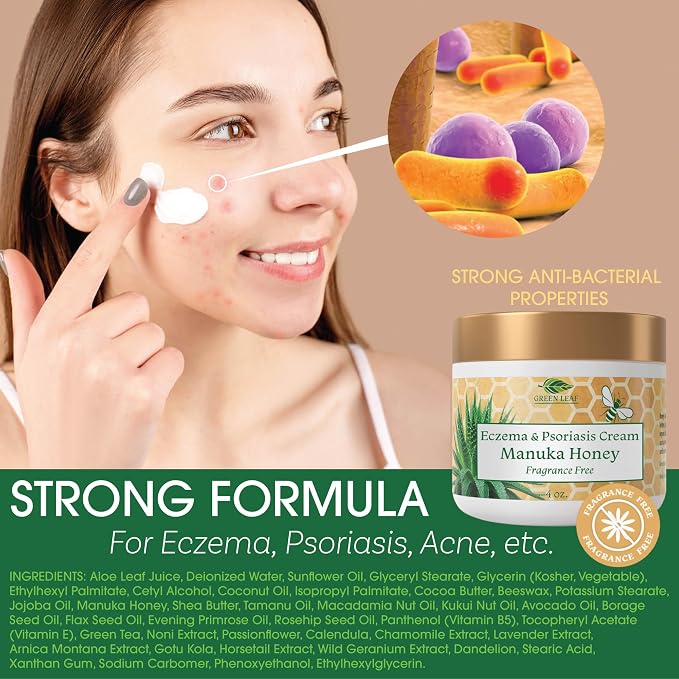 Manuka Honey Eczema Cream Moisturizing Lotion Fragrance Free - Image 2
