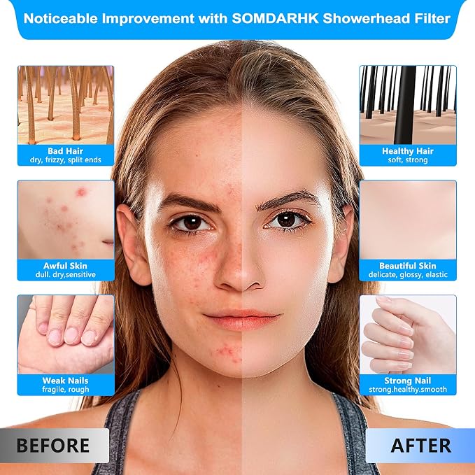 Filtered Shower Head with Filters: Removes Chlorine & Heavy Metals High - Image 2