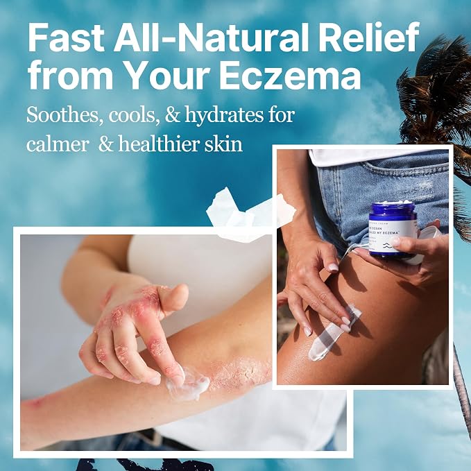 The Ocean Healed My Eczema Natural & Soothing Eczema Cream - Image 4