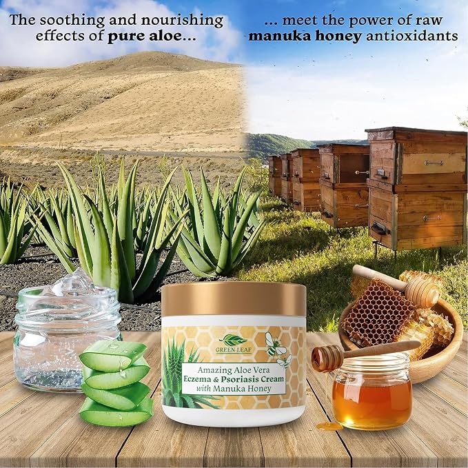 Manuka Honey Eczema Cream Moisturizing Lotion Treatment - Image 4