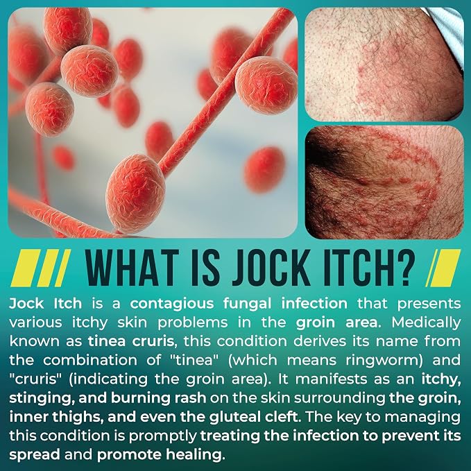 Jock Itch Powder with Miconazole Nitrate 2% & Tea Tree Oil - Image 5