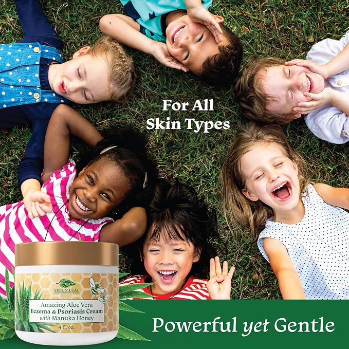 Manuka Honey Eczema Cream Moisturizing Lotion - Image 5